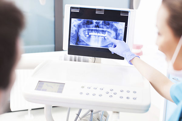 DENTAL IMPLANTS TECHNOLOGY