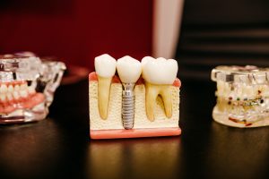dentistry trends 2023 2022 orthodontics trending